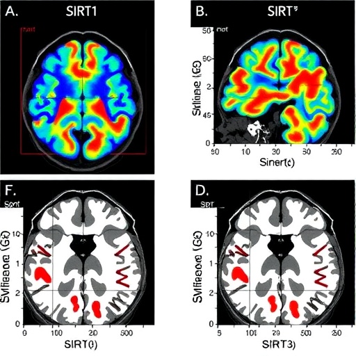 sirt1-and-sirt3-levels-after-fatal-brain-injury