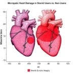 microscopic-heart-damage-in-steroid-users-vs.-non-users