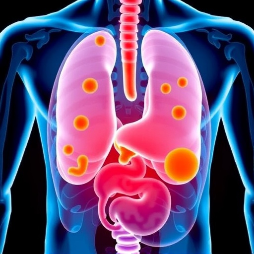 curcumin’s-role-in-prostate-cancer-therapy