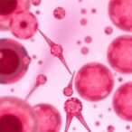 mesenchymal-stem-cell-media-aids-high-glucose-damaged-huvecs