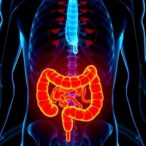 nicotinamide-riboside-reduces-radiation-induced-intestinal-injury