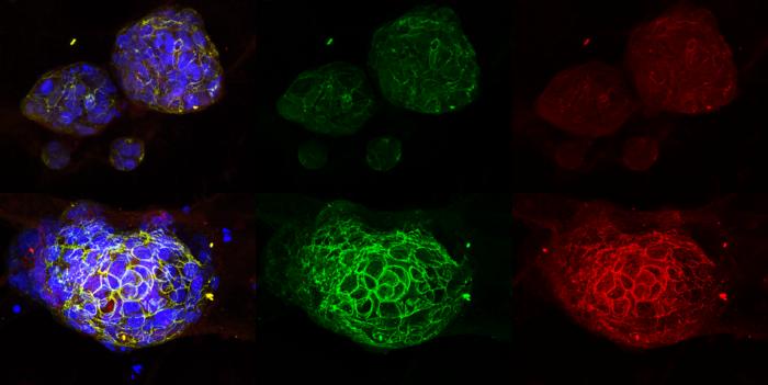 ai-treatment-reprograms-and-triggers-cancer-stem-cells-to-self-destruct