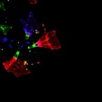 exosomal-mir-122-5p-fights-kidney-fibrosis-via-hif-1α