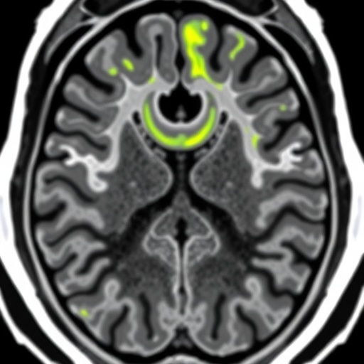 ai-predicts-liver-cancer-invasion-via-mri