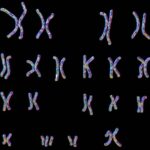 overactive-hmgn1-may-underlie-heart-defects-in-down-syndrome