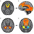 neural-signatures-of-turn-freezing-in-parkinson’s-disease