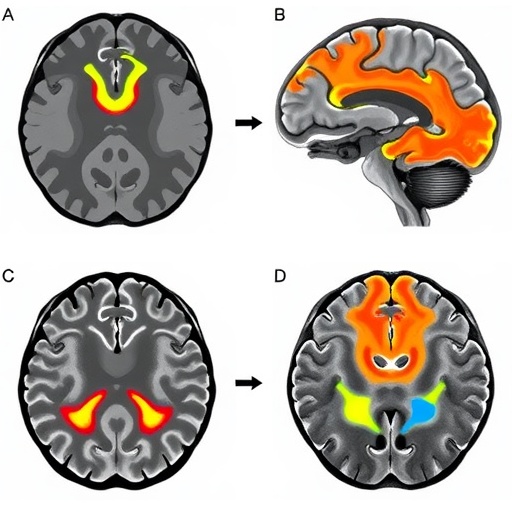 neural-signatures-of-turn-freezing-in-parkinson’s-disease