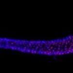hitchhiking-dna-in-c.-elegans-solves-telomerase-puzzle,-with-regenerative-promise