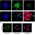 silencing-sox2ot-lowers-lung-cancer-cell-aggressiveness