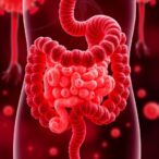 gut-infection,-dysbiosis-mark-severe-sars-cov-2-variants