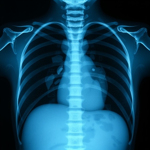 optimizing-anatomical-markers-in-neonatal-chest-x-rays