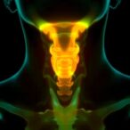 lamb3-expression-linked-to-thyroid-cancer