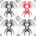 ai-models-for-urothelial-neoplasm-classification-validated