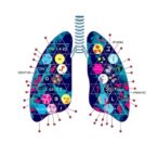 metagenomic-sequencing-uncovers-pneumonia-pathogen-strains