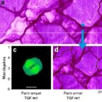 tgf-β1-modulates-macrophages,-reduces-painful-neuromas