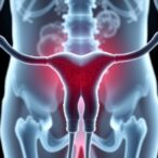 researchers-identify-key-factor-driving-ovarian-cancer-metastasis