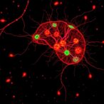 ezrin-loss-causes-mitochondrial-dysfunction,-neuronal-death