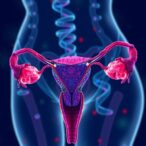 how-gwas-gene-environment-interactions-and-reproductive-history-influence-uterine-fibroid-risk