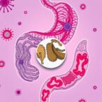 hiv-and-antiretrovirals-impact-diverse-gut-microbiomes