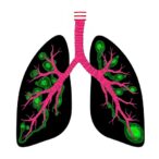 ecm,-rock,-and-polarity-orchestrate-lung-growth