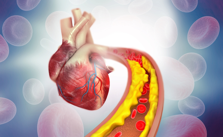 ldlr-gene-variants-linked-to-increased-‘bad’-cholesterol-and-heart-attack-risk