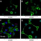 acss2-enhances-ovarian-cancer-cell-growth-in-hypoxia