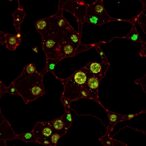 trim32-facilitates-immune-evasion-in-gastric-cancer