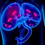 unraveling-slamf8’s-role-in-prostate-cancer-metastasis