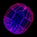 plasma-micrornas-differentiate-focal-cortical-dysplasia-types