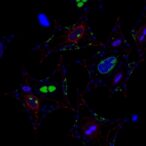 studying-smad2-mutations-reveals-podocytogenesis-changes