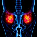 ai-radiomics-accurately-differentiates-endometrial-tumors