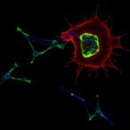 ccdc137-knockdown-hinders-bladder-cancer-via-scd-downregulation