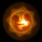 successful-live-birth-from-tripronuclear-zygote-enucleation