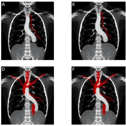 ai-powered-image-alignment-in-carotid-angiography-study