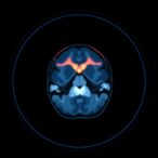 enhancing-infant-mri:-deep-learning-vs.-anesthesia