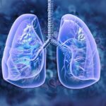 icecure’s-cryoablation-treatment-may-extend-survival-in-some-lung-cancer-patients,-study-finds