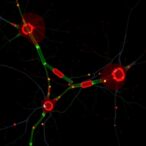 children’s-blood-methylome-signals-shield-against-islet-autoimmunity