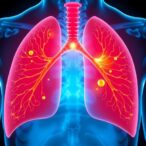 inflammation-could-trigger-the-earliest-stages-of-lung-cancer