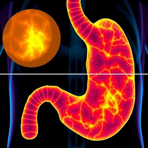 tumor-index-predicts-stage-i-gastric-cancer-recurrence