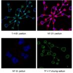 tβ4–17-boosts-ovarian-cancer-chemo-sensitivity-via-nf-κb