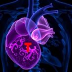 coronary-artery-calcium:-a-potential-indicator-of-overall-mortality-beyond-heart-disease