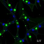 mir-770-5p-regulates-klf4/egfr-via-prmt5