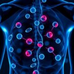 deregulation-of-nkx3.1-and-aurka-in-prostate-cancer