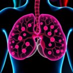 sphingolipid-metabolism:-a-target-in-triple-negative-breast-cancer