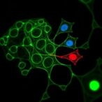 tfap2c-boosts-cst1,-promoting-breast-cancer-growth