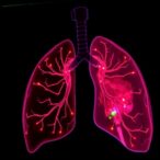 exploring-hsa-mir-1247-5p-and-trib2-in-sepsis-lung-injury