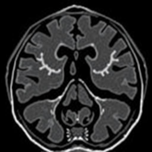 mr-urography-assesses-pediatric-upj-obstruction-treatment