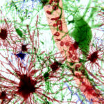improving-astrocyte-function-shows-promise-for-alzheimer’s