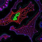 scutellarin-induces-ferroptosis-by-blocking-akt/mtor,-jak2/stat3
