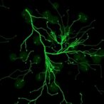 cd24a-knockout-boosts-anti-tumor-immune-response